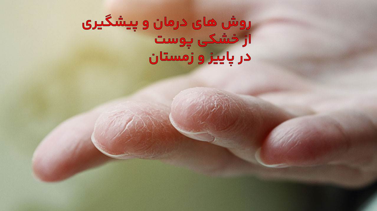 خشکی پوست در پاییز و زمستان و روش های درمان و پیشگیری
